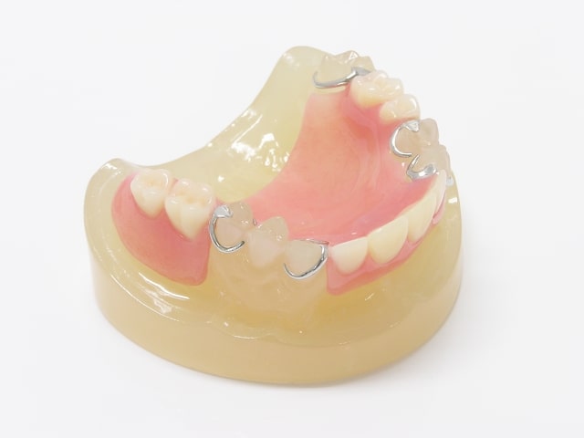 ブリッジ治療をイメージした歯の模型
