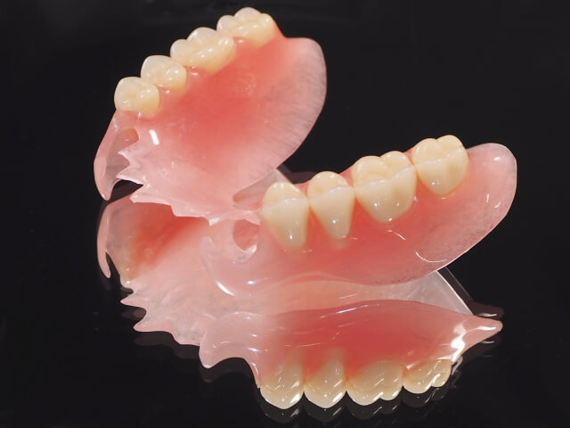 局部義歯の模型